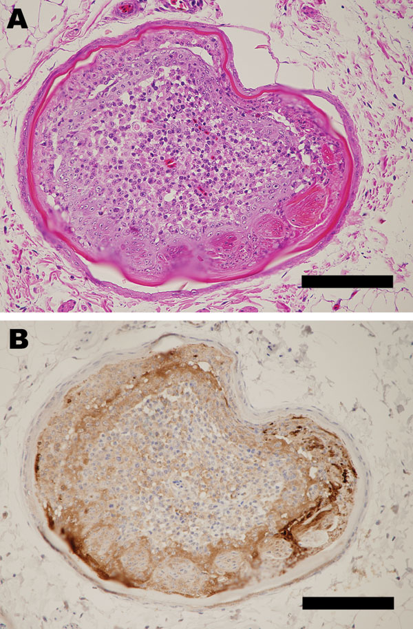 Pathologic changes in a goose infected with A/chicken/Miyazaki/K11/2007. A) Outer epidermal necrosis of the feather with inflammation in the inner feather pulp. Hematoxylin and eosin stain. Bar = 120 μm. B) Influenza viral antigens detected in feather epidermal cells. Immunohistochemistry. Bar = 120 μm.