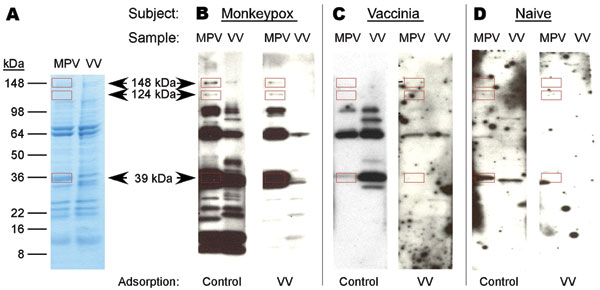 Development of a monkeypox (MPV)–specific diagnostic assay using Western blot analysis. Adsorption of cross-reactive orthopoxvirus antibodies with vaccinia antigen before Western blot analysis provided easier identification of monkeypox-specific bands. A) Two micrograms of sucrose gradient–purified monkeypox virus or vaccinia virus (VV) were separated by sodium dodecyl sulfate–polyacrylamide gel electrophoresis (4%–20% gels) and stained with GelCode Blue (Pierce, Rockford, IL, USA) to compare banding patterns and confirm equivalent protein loading. Proteins were electrophoretically transferred to polyvinylidene difluoride membranes and probed with plasma from B) a monkeypox-immune person, C) a vaccinia-immune person, or D) an orthopoxvirus-naive person after adsorption of plasma with control antigen (uninfected H2O2-treated BSC40 cell lysate) or vaccinia antigen (H2O2-inactived vaccinia-infected BSC40 cell lysate). Immunoreactive bands were detected with peroxidase-conjugated antihuman immunoglobulin G plus chemiluminescent substrate and exposed to x-ray film. Arrows indicate location of diagnostic bands with apparent molecular masses of 148, 124, and 39 kDa. Rectangles indicate locations of diagnostic bands.