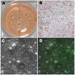 Thumbnail of Photographs of light and fluorescent microscopy showing the shotgun cell culture harvest method for isolating clonal populations of clinically persistant strains. A) 1 well in a 6-well plate after harvesting 10 random areas using sterile pipettes; no plaques could be visualized in any well unlike the situation for the reference strains in Figure 2. B) The same well before harvesting infected areas (magnification ×100). C) Light microscopy view of an area with infected cells containing small inclusion bodies after agarose overlays had been removed (magnification ×400). D) Fluorescent microscopy view of the same field as in C (magnification ×400); infected cells were stained with Chlamydia trachomatis–specific lipopolysaccharide antibodies. Arrows denote small fluorescing inclusion bodies within the cell cytoplasm.