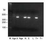 Thumbnail of Seminested PCR detection of Bartonella spp. DNA in Ixodes ricinus ticks fed on B. henselae–infected ovine blood at preceding stage. Lane M, 100-bp DNA molecular mass marker; lane Ags, salivary glands of a female adult fed on infected blood as a nymph; lane A, carcass of a female adult fed on infected blood as a nymph; lane Ngs, salivary glands of a nymph fed on infected blood as a larva; lane N, carcass of a nymph fed on infected blood as a larva; lane E, eggs laid by female adult fed on infected blood; lane L, larvae hatched from female adult fed on infected blood; lane T+, B. bacilliformis DNA; lane T–, nymph fed on uninfected ovine blood.