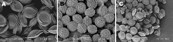 Scanning electron microscopic images of ascospores of some Emericella isolates. A) E. quadrilineata V43-63; B) E. rugulosa V43-77; C) E. nidulans var. echinulata 4606. Scale bars represent 5 μm.