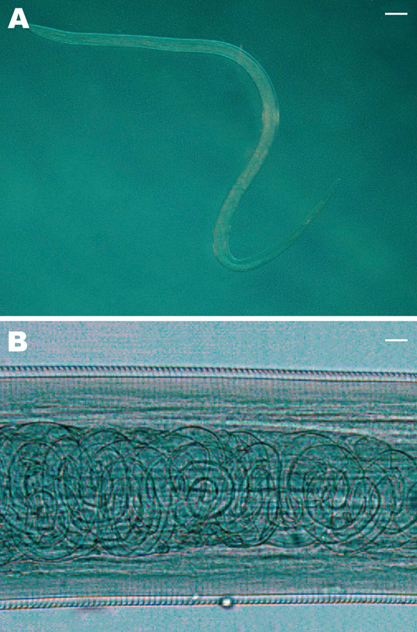 A) Female Thelazia callipaeda isolated from patient 4. The posterior end is on the left and the anterior end is on the right (magnification × 200). Scale bar = 500 μm. B) T. callipaeda mature first-stage larvae in the distal uterus (magnification ×100). Scale bar = 30 μm.