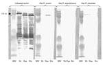 Thumbnail of Western blot assay (WB) and cross-adsorption studies in serum of a patient with rickettsiosis in Algeria. Immunofluorescent assay showed raised levels of immunoglobulin (Ig) G/M at the same titer (2,048/32) against Rickettsia conorii, R. aeschlimannii, and R. massiliae. Lanes Rc, Rae, and Rm: WB assay using R. conorii, R. aeschlimannii, and R. massiliae antigens, respectively. MW, molecular weights are indicated on the left. Untreated serum, late serum samples tested by WB. When adsorption is performed with R. aeschlimannii antigens, homologous and heterologous antibodies disappear, but when it is performed with R. conorii antigens and R. massiliae, homologous antibodies disappear but heterologous antibodies persist. This result indicates that antibodies are specifically directed against R. aeschlimannii. Abs, absorbed.