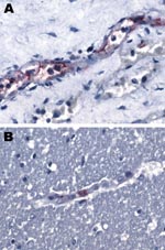Thumbnail of A small vessel in the kidney (A) and a capillary in the cerbral cortex (B) positive with immunohistochemical stain specific for spotted fever group rickettsiae. Original magnification ×158.