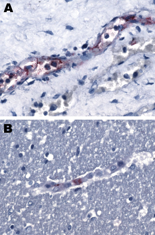 A small vessel in the kidney (A) and a capillary in the cerbral cortex (B) positive with immunohistochemical stain specific for spotted fever group rickettsiae. Original magnification ×158.