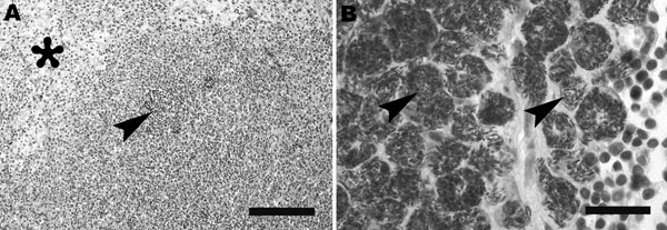 A) Mesenteric lymph node of Yorkshire Terrier shows diffuse granulomatous lymphadenitis with extensive infiltration of macrophages, foci of pyogranulomatous inflammation (arrowhead), and focal necrosis (asterisk). Hematoxylin and eosin stain; scale bar represents 100 μm. B) Retropharyngeal lymph node of schnauzer shows innumerable acid-fast bacilli (arrows) within the cytoplasm of macrophages. Ziehl-Neelsen stain; scale bar represents 25 μm.