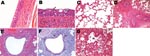 Thumbnail of Histopathologic lesions in the trachea and lungs of control (A and C) or experimentally infected (B, D–F) dogs (A/canine/Korea/01/2007 [H3N2]) at different days postinoculation (dpi). A) Control dog at 9 dpi, showing normal pseudostratified columnar epithelium lining of the trachea; original magnification ×400. Hematoxylin and eosin (HE) stain. B) Influenza-infected dog at 9 dpi, showing necrotizing tracheitis characterized by necrosis (n), squamous metaplasia (s), and hyperplasia of the epithelium and nonsuppurative inflammation (c) in the connective tissue; original magnification ×400. HE stain. C) Control dog at 3 dpi, showing normal alveoli; original magnification ×200. HE stain. D) Influenza-infected dog at 3 dpi, showing severe diffuse necrotizing bronchitis and bronchiolitis with suppurative inflammation in the lumina; original magnification ×100. HE stain. E) Influenza-infected dog at 6 dpi, showing severe necrotizing bronchiolitis; original magnification ×200. HE stain. F) Influenza-infected dog at 6 dpi (serial section of E), showing large amounts of influenza A virus antigens (red stain; arrows) in the bronchiolar epithelium and lumen. Immunohistochemistry; Red Substrate (Dako, Carpinteria, CA, USA); Mayer’s hematoxylin counterstain. G) Influenza-infected dog at 9 dpi, showing severe necrotizing alveolitis with accumulation of necrotic cells in terminal bronchioles (tb) and alveoli (a); original magnification ×200. HE stain.