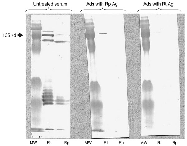 Western blot assay and cross-adsorption studies of an immunofluoresence assay–positive serum sample from a patient with rickettsiosis in Algeria. Antibodies were detected at the highest titer (immunoglobulin [Ig] G 256, IgM 256) for both Rickettsia typhi and R. prowazekii antigens. Columns Rp and Rt, Western blots using R. prowazekii and R. typhi antigens, respectively. MW, molecular weight, indicated on the left. When adsorption is performed with R. typhi antigens (column Ads with Rt Ag), it results in the disappearance of the signal from homologous and heterologous antibodies, but when it is performed with R. prowazekii antigens (column Ads with Rp Ag), only homologous antibody signals disappear, indicating that the antibodies are specific for R. typhi.