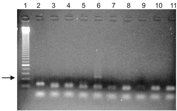 PCR amplification of a 134-bp fragment of ancient DNA of Plasmodium falciparum in Egyptian mummies. Lane 1, molecular marker; lanes 10 and 11, 2 negative controls. One (lane 6) of 8 samples shows a positive amplification product (arrow). Specificity of the product was verified by sequencing.