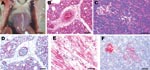 Thumbnail of Experimental studies in chickens inoculated intranasally with highly pathogenic influenza A/chicken/Nigeria/228-5/2005 (H5N1) and sampled 2 days postinoculation. A) Photograph (scale bar = 1 cm) of a gross lesion, showing petechia in epicardial fat in the coronary groove. B,C) Photomicrographs (scale bars = 50 μm) of tissue sections stained with hematoxylin and eosin, showing severe histiocytic and heterophilic interstitial pneumonia with moderately interlobular edema (panel B) and pancreatic acinar epithelium (panel C). D–F) Photomicrographs (scale bars = 50 μm) of tissue sections stained immunohistochemically to demonstrate avian influenza virus nucleoprotein, showing avian influenza virus antigen in pulmonary and blood vessel endothelial cells and histiocytes (panel D), nuclei and cytoplasm of cardiac myocytes (panel E), and pancreatic acinar epithelium and islet cells (panel F).