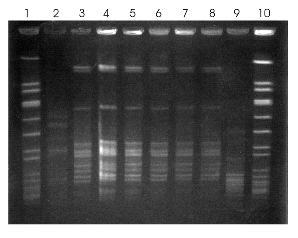 Results of pulsed-field gel electrophoresis (PFGE) of Sphingomonas paucimobilis isolates obtained in November 2007. Lanes 1 and 10, molecular weight marker; lanes 2–7, bloodstream isolates from patients 1–6, respectively; lane 8, isolate from contaminated fentanyl; lane 9, unrelated control isolate. Patients 2 through 6 received intravenous fentanyl within 48 hours before S. paucimobilis bacteremia developed and had isolates with a PFGE pattern indistinguishable from that of fentanyl isolates. P