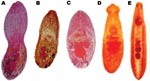 Thumbnail of Adult trematodes recovered from domestic animals in Nghe An Province, Vietnam. A) Haplorchis taichui; B) H. pumilio; C) H. yokogawai; D) Echinochasmus japonicus; E) Echinostoma cinetorchis.