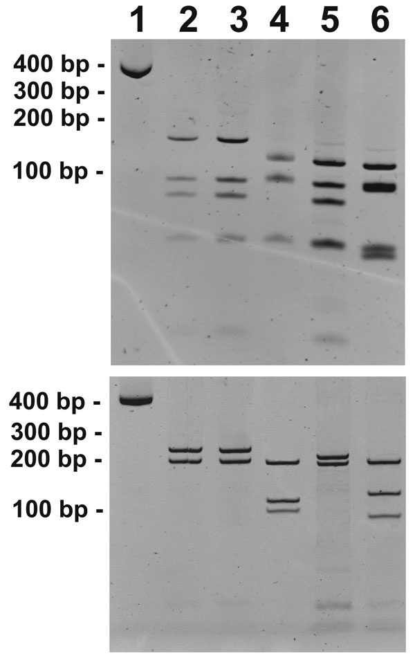 Restriction fragment length polymorphism patterns of gltA (A) and 17-kDa gene (B) PCR products digested with AluI. Lane 1, undigested gltA and 17-kDa gene PCR amplicons (from blood sample of infected child); lane 2, human case; lane 3, Rickettsia typhi–positive control; lane 4, R. felis–positive control; lane 5, R. akari–positive control; lane 6, R. rickettsii–positive control.
