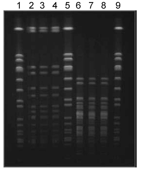 Contour-clamped homogenous electric field electrophoresis of Staphylococcus aureus isolates. Lanes 2, 3, and 4 (Sma1 restriction): methicillin-resistant S. aureus (MRSA) isolated from Mrs A’s first infection, Mr A’s blood culture, and Mrs A’s second infection, respectively. Lanes 6, 7, and 8 (Apa1 restriction): MRSA isolated from Mrs A’s first infection, Mr A’s blood culture, and Mrs A’s second infection, respectively. Lanes 1, 5, and 9: S. aureus NCTC8325.