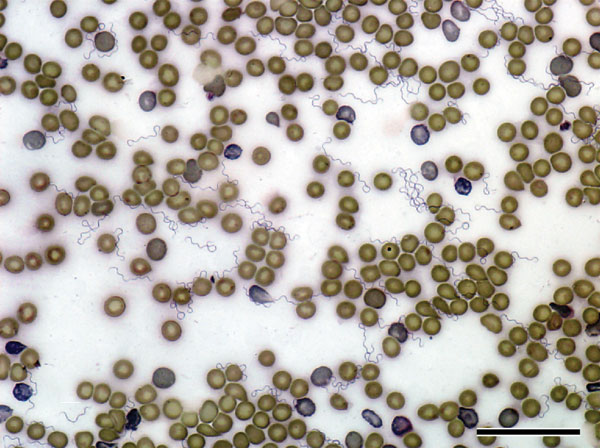 Borrelia hermsii MTW-2 in mouse blood (Wright-Giemsa stain) viewed at 600× oil immersion. Scale bar = 40 μm.