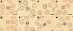 Thumbnail of Morphology of Plasmodium knowlesi in a Giemsa-stained thin blood smear. Infected erythrocytes were not enlarged, lacked Schuffner stippling, and contained much pigment. Shown are examples of trophozoites (A–F), a schizont (G), and a gametocyte (H). Scale bars = 5 μm.