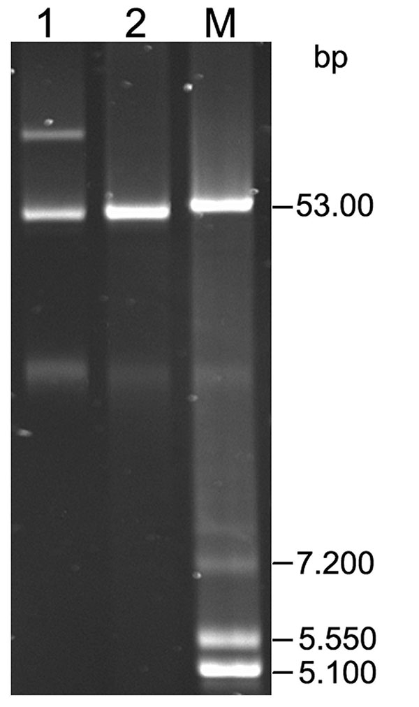 Plasmids isolated from Salmonella enterica serovar Typhi and Escherichia coli J53 transconjugant. Lane 1, S. enterica ser. Typhi 218/08 (blaCTX-M-15 + blaTEM-1 + qnrB2); lane 2, E. coli J53 transconjugant (blaCTX-M-15 + qnrB2); lane M, plasmid marker E. coli V517.