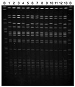Thumbnail of Pulsed-field gel electrophoresis patterns of rmtC-positive Salmonella enterica serovar Virchow isolates. Lanes: B, S. Braenderup H9812 size standard; 1, H0 5164 0340; 2, H0 5366 0426; 3, H0 6018 0151; 4, H0 6136 0322; 5, H0 6398 0463; 6, H0 7078 0136; 7, H0 7310 0210; 8, H0 7468 0335; 9, H0 7474 0467; 10, H0 7496 0137; 11, H0 7512 0259; 12, H0 8354 0857; and 13, H0 8512 0713.