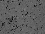 Thumbnail of Gram-positive cocci, mostly in pairs and short chains, found in cerebrospinal fluid from a 34-year-old man with Streptococcus suis meningitis. The sample was not centrifuged before staining. Original magnification ×1,000.