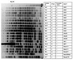 Thumbnail of Pulsed-field electrophoresis (PFGE) profiles of ApaI-digested genomic DNA from strains of Acinetobacter baumannii. PFGE types, European clone types, and multilocus sequence typing (MLST) results are shown. *ST, sequence type determined by Bartual et al. (19) compared with ST determined by Nemec et al. (20). Lane M, molecular size markers (48.5 kb).