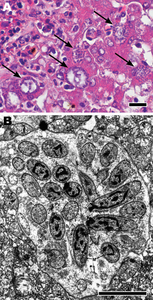 A) Microscopic appearance of liver with tissue necrosis, lymphohistiocytic inflammation, and Sarcocystis schizonts (arrows) in a pigeon 8 days after infection with 105 Sarcocystis sporocysts. Hematoxylin and eosin stain; scale bar = 20 μm. B) Transmission electron micrograph of a hepatocyte from liver in panel A, containing a schizont, forming cross-sectioned and longitudinally sectioned merozoites. N, nucleus; PV, parasitophorous vacuole; M, merozoite. Scale bar = 20 μm.
