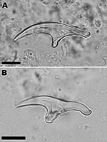 Thumbnail of Large (A) and small (B) hooks from Echinococcus vogeli protoscoleces in the liver lesion of a 72-year-old man from French Guiana. Scale bars = 10 μm.