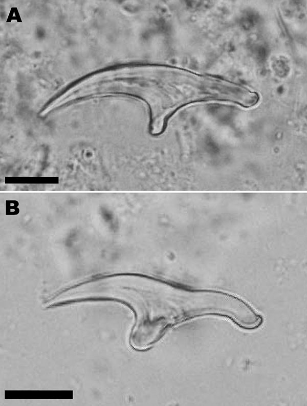 Large (A) and small (B) hooks from Echinococcus vogeli protoscoleces in the liver lesion of a 72-year-old man from French Guiana. Scale bars = 10 μm.