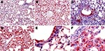 Thumbnail of Topologic distribution of influenza antigens in the lungs of mice infected with influenza virus A subtype H1N1 and H5N1 strains at endpoint (antinucleoprotein immunohistochemical staining). A) Subtype H1N1 and B) subtype H5N1, both showing diffusely distributed positive staining of numerous pneumocytes and alveolar macrophages (original magnification ×100). C) Subtype H1N1, showing antigens massively present in the remaining non-desquamated airway epithelial cells (original magnific