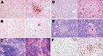 Thumbnail of Topologic distribution of antigens in mice infected with influenza A virus subtype H1N1 at day 7 postinfection (left columns) and subtype H5N1 at day 4 postinfection (right columns) in various nonrespiratory organs. A) Glial cells (mostly oligodendrocytes); B) cardiomyocytes; C) spleen macrophages; D) hepatocytes; E) islets of Langerhans cells in the pancreas; and F) adipocytes. Bright virus-positive staining can be seen in subtype H5N1–infected mice (antinucleoprotein immunohistoch