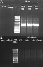 Thumbnail of PCR of avian bornavirus N-protein in different areas of the brains of A) 2 Patagonian conures (PG7 and PG8) inoculated 55 days earlier with avian bornavirus–infected duck embryonic fibroblasts and B) control, uninfected bird, PG5. HB, hindbrain; FB, forebrain; MB, midbrain; Cereb., cerebrum.
