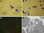 Thumbnail of Photomicrographs of cells infected with Anaplasma phagocytophilum. A) Wright-Giemsa–stained granulocytic cell of a BALB/c mouse. B) Wright-Giemsa-stained HL60 cells. C) Immunofluorescent-stained infected HL60 cells. D) Electron photomicrographs of an HL60 cell. Original magnifications ×1,500 (A–B), ×1,000 (C), and ×6,200 (D).
