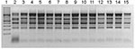 Thumbnail of Enterobacterial repetitive intragenic consensus (ERIC)–PCR ERIC2 primers. Lane 1, molecular mass ladder; lanes 2–7, nonoutbreak isolates; lanes 8–9, isolates from baby tea; lane 10, isolate from fennel; lanes 11–15, isolates from salmonellosis patients. ERIC PCR with ERIC2 primer (5′-AAGTAAGTGACTCGGGTGAGCG-3′) was used. DNA was isolated by using the InvitrogenPure Link Genomic DNA purification kit (Invitrogen, Carlsbad, CA, USA). Gene sequences were amplified in a Perkin/Elmer therm