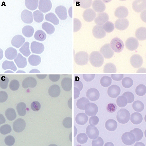 Figure - Plasmodium knowlesi in Human, Indonesian Borneo - Volume 16 ...