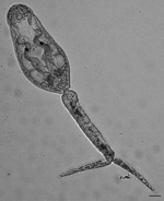 Thumbnail of Live schistosome cercaria from a Haminoea japonica snail. Scale bar = 30 µm. Measurements are shown in Table 2.