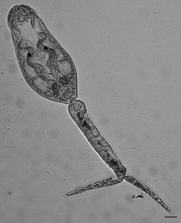 Live schistosome cercaria from a Haminoea japonica snail. Scale bar = 30 µm. Measurements are shown in Table 2.