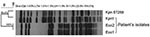 Thumbnail of Pulsed-field gel electrophoresis demonstrating genetic relatedness of study isolates Eco2, Eco1, and Kpn1, and a representative Klebsiella pneumoniae isolate of the epidemic clone, Kpn ST258, Israel, 2008. Bacterial DNA was prepared and cleaved with 20U SpeI endonuclease (New England Biolabs, Beverly, MA, USA), followed by electrophoresis in a CHEF-DR III apparatus (Bio-Rad Laboratories, Inc., Hercules, CA, USA), as described (4). The macrorestriction patterns of the isolates were c