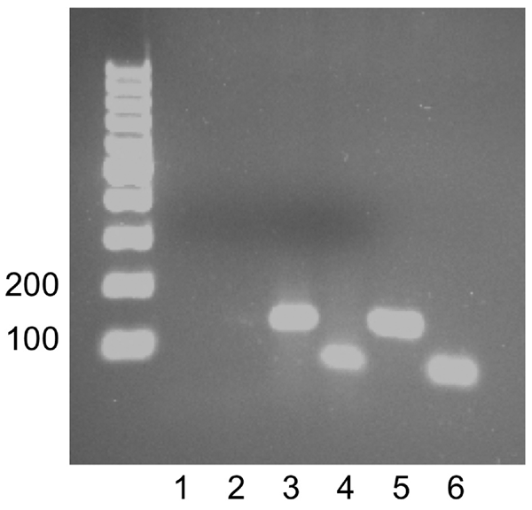 Detection of Granulibacter sp. DNA by PCR of the spleen of a patient with chronic granulomatous disease. Lanes 1 and 2, no template controls for each primer set; lane 3, 400 ng of spleen DNA amplifying Granulibacter sp. 16S rRNA gene; lane 4, 400 ng of spleen DNA amplifying the Granulibacter sp. methanol dehydrogenase gene; lane 5, 100 ng DNA from the G. bethesdensis type strain amplifying the 16S rRNA gene (positive control); lane 6, 100 ng DNA from the G. bethesdensis type strain amplifying th