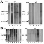 Thumbnail of Western blot analysis of immunoglobulin (Ig) G and IgM against Tropheryma whipplei for children with gastroenteritis, Marseille, France. Total native antigens from T. whipplei were tested. A) Five patients without T. whipplei detected from stool samples but with positive Western blot serologic results. B) Eight patients infected with T. whipplei. MWM, molecular weight markers. Values on the right of each blot are in kilodaltons.
