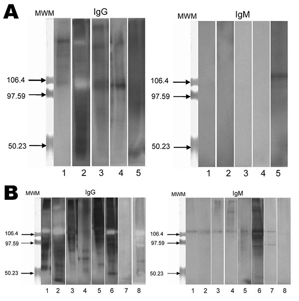 Western blot analysis of immunoglobulin (Ig) G and IgM against Tropheryma whipplei for children with gastroenteritis, Marseille, France. Total native antigens from T. whipplei were tested. A) Five patients without T. whipplei detected from stool samples but with positive Western blot serologic results. B) Eight patients infected with T. whipplei. MWM, molecular weight markers. Values on the right of each blot are in kilodaltons.