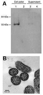 Thumbnail of A) Confirmation of isolation of Lassa virus (LASV) Soromba-R by using immunoblot analysis of cell pellets and supernatant from LASV Soromba-R-infected Vero E6 cells (lanes 1 and 3) or uninfected controls (lanes 2 and 4) with a LASV nucleoprotein-specific monoclonal antibody. B) Electron micrograph of LASV particles