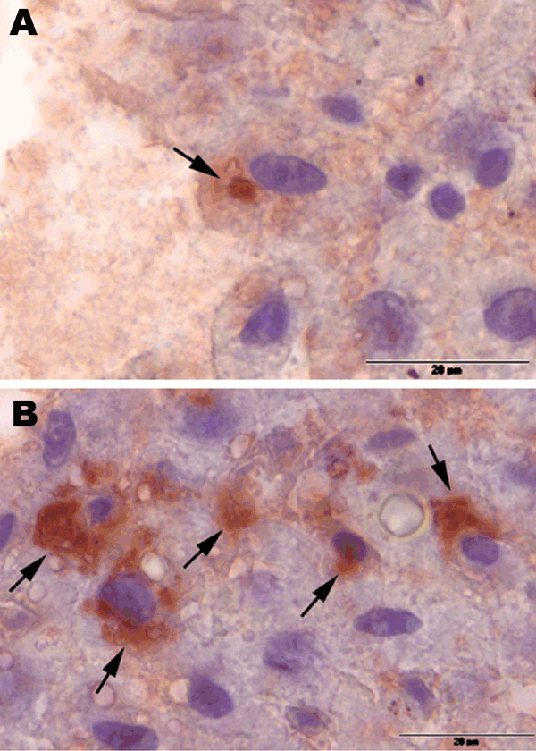 Immunohistochemical staining (peroxidase-antiperoxidase (PAP) technique) of liver samples from 2 rat-hepatitis E virus (HEV)–positive Norway rats from Germany, July 2009. Arrows indicate immunohistochemical positive reactions in the cytoplasm of single hepatocytes (A) and in a few foci in hepatocytes and stellate cells (B). For PAP staining, deparaffinized slides of liver samples were incubated with anti-HEV–positive human serum, which had been previously used to detect rat HEV by using solid ph