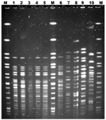 Thumbnail of Representative XbaI pulsed-field gel electrophoresis patterns of Shiga toxin–producing Escherichia coli (STEC) O123:H– strains isolated from patient fecal samples and strains isolated from ground beef obtained from patients’ home, France, 2009. Lanes M, XbaI-digested genomic DNA from Salmonella enterica serovar Braenderup H9812 used as molecular mass markers; lane 1, Shiga toxin–producing STEC O123:H– isolated from patient with hemolytic uremic syndrome; lane 2, STEC O123:H– isolate