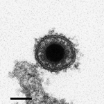 Thumbnail of Electron micrograph image of cyprinid herpesvirus 3 virion. Scale bar = 100 nm. Adapted with permission from Mettenleiter et al. (7).