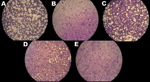 Thumbnail of Effects of temperature on cyprinid herpesvirus 3 replication in Cyprinus carpio carp brain cells. After infection, cells were kept at 22°C (A) or shifted to 30°C (B–D); some cells were returned to 22°C at 24 hours (C) or 48 hours (D) postinfection. Uninfected control cells (E) and infected cells at 9 days postinfection were fixed, stained, and photographed. Viral replication was highest in cells maintained at 22°C and lowest in those maintained at 30°C. Original magnification ×20. A