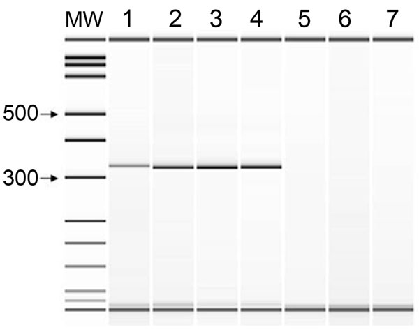 PCR amplification with primers TFR3 and TFR4. Lane 1, Tritrichomonas foetus ATCC 30231; lane 2, peritoneal fluid specimen; lane 3, culture of peritoneal fluid; lane 4, T. suis ATCC 30167; lane 5, Pentatrichomonas hominis; lane 6, Trichomonas tenax; lane 7, no template control. MW, molecular size standard. Values at left are bp.