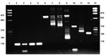 Thumbnail of Testing for xenotropic murine leukemia virus–related virus (XMRV) in patients with fibromyalgia. Lanes 1 and 13, molecular weight marker ΦX174RF HaeIII; lanes 2–5, hBG for patients 1–4 (primers: hBG-FI-170/hBG-RI-273 (103 bp); lanes 6–12, positive control (pcDNA3.1-XMRV-Vp62) 1,000 copies (lanes 6 and 10) and 100 copies (lanes 7–9 and 11–12); lane 6, primers gag 419F/1154R (735 bp); lane 7, primers gag MLV-GAG-I-F/MLV-GAG-I-R (413 bp); lane 8, primers gag MLV-NP116/MLV-NP117 (380 bp