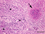 Thumbnail of Liver from a juvenile wild rabbit with numerous oval Eimeria stiedae oocysts in the convoluted hyperplastic bile ducts (asterisks) and necrotizing hepatitis (arrow) by Francisella tularensis. Hematoxylin and eosin stain; scale bar = 200 µm.