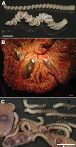 Thumbnail of Adult and larval Armillifer armillatus parasites. A) Ventral view of 2 adult A. armillatus parasites recovered from the lungs and trachea of a deceased rock python; a gravid female (bottom) and a pre-adult female (top) are shown. The parasites showed 20 and 18 marked body rings, and had a length of 10 cm and 9 cm and a body width of 5–8 mm and 3–5 mm, respectively. B) Heavily parasitized omentum of a female stray dog, showing typical encapsulated C-shaped larval stages of A. armilla