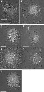 Thumbnail of Light micrograph images of acanthamoebae infected with mimivirus-like particles, showing cells packed with mimivirus-like particles. Enlargement of region of image is shown at bottom of panel A. White arrows in panels B and D indicate free virus-like particles. pVF, putative viral factory. Scale bars = 10 µm.