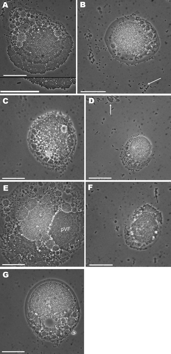Light micrograph images of acanthamoebae infected with mimivirus-like particles, showing cells packed with mimivirus-like particles. Enlargement of region of image is shown at bottom of panel A. White arrows in panels B and D indicate free virus-like particles. pVF, putative viral factory. Scale bars = 10 µm.